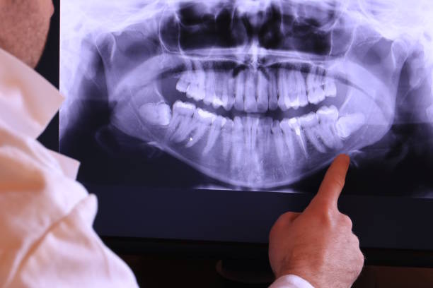 Best Dentist for Severe Toothache  in Wesson, MS